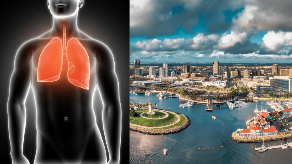 Tuberculosis Outbreak Sparks Public Health Emergency in Long Beach Tuberculosis Outbreak