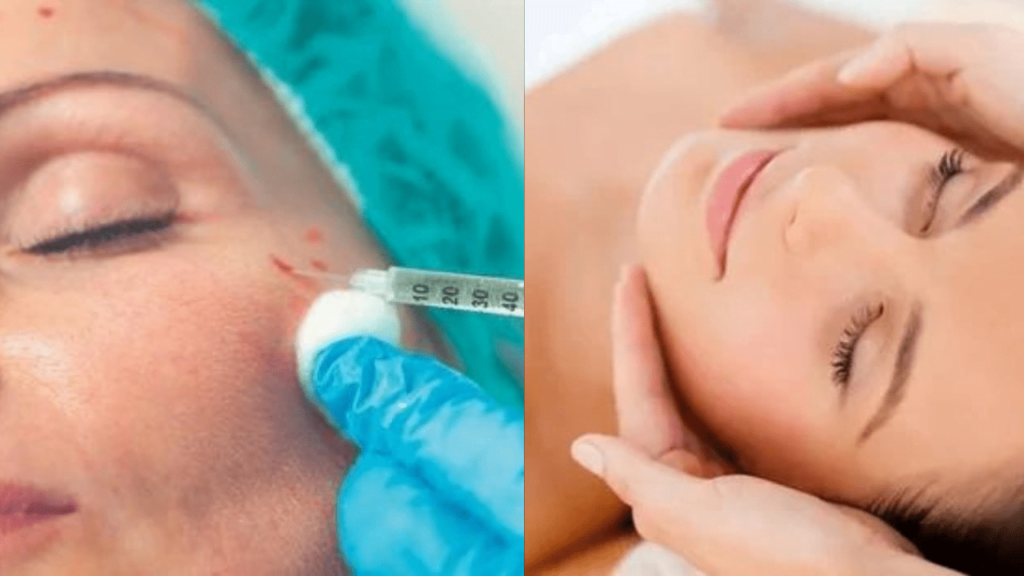 Vampire Facial: A Bloody Scary Beauty Trend in 2024? Vampire Facial