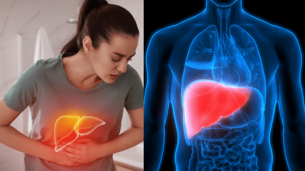 Cracking the Secrets of Fatty Liver in 2024: Types, Root Causes, and Potent Remedies Fatty Liver