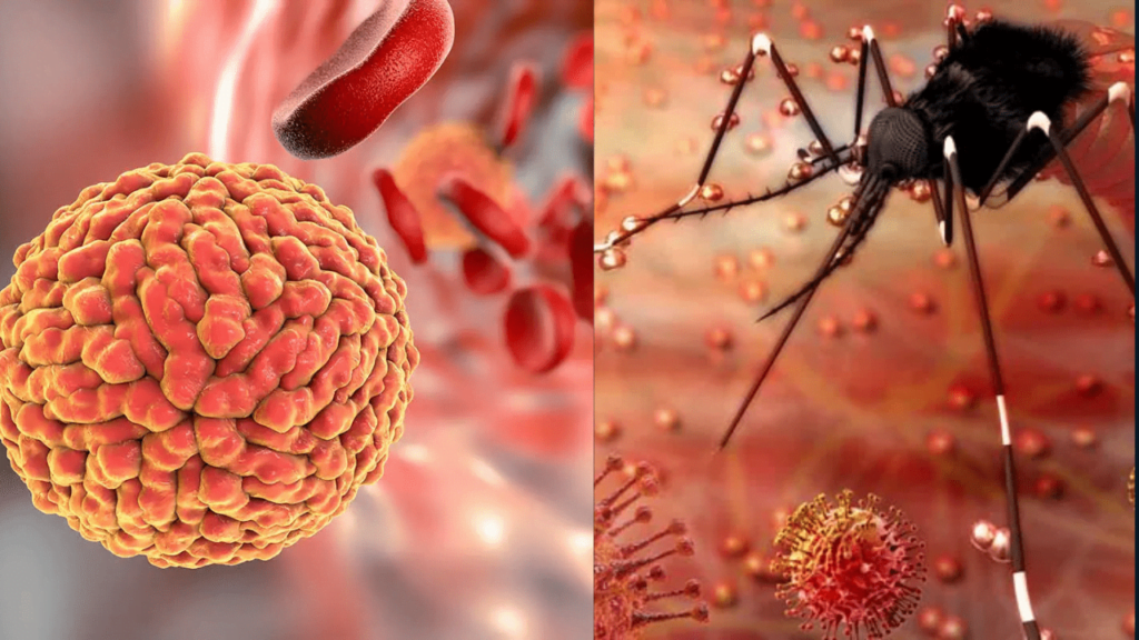 Zika Virus Alert: Essential Guidelines for Pregnant Women to Stay Safe in 2024 Zika virus