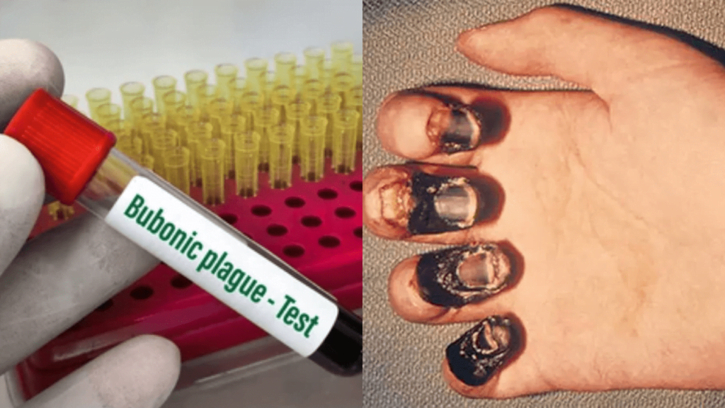 Bubonic Plague in Colorado: A Modern-Day Encounter with the Deadly Disease Bubonic Plague in Colorado A Modern-Day Encounter with the Deadly Disease