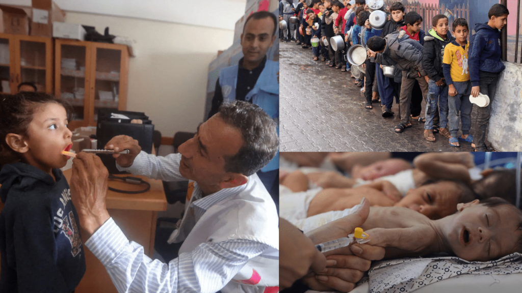 Health Crisis in Gaza: Over 150,000 Suffer from Skin Diseases in War-Torn Territory